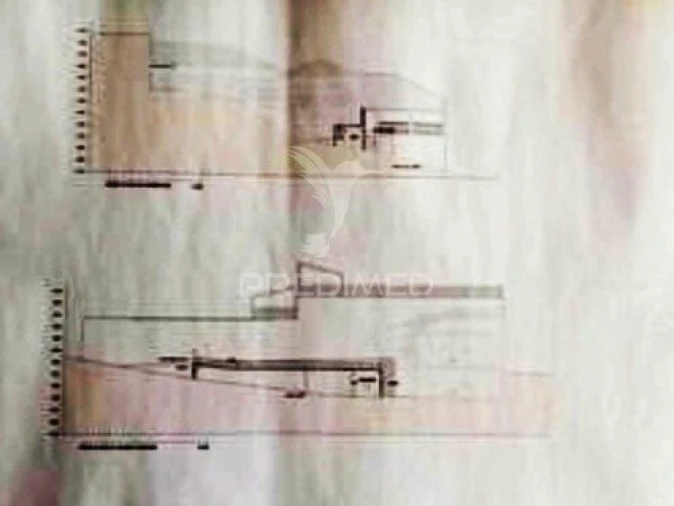 Moradia T2 para Venda em Borbela e Lamas de Olo Foto 7